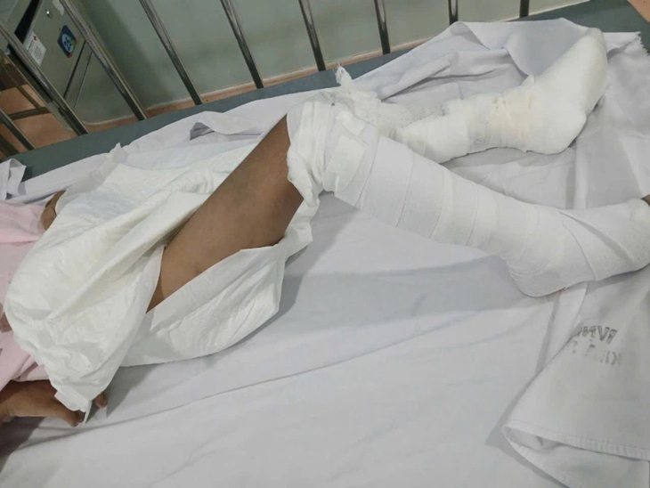 hinh-chau-be-bi-bao-hanh-17278549346451013614068 Bé trai 6 tuổi, nghi bị cha bạo hành, bị phỏng nước sôi độ 2-3 - Ảnh 1.