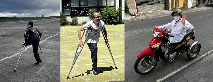 Nguyễn Đức (sinh 25-2-1981) - người em trai song sinh trong ca mổ tách dính năm 1988 - nhân vật chính của bộ phim tài liệu - Ảnh: ĐPCC Nguyễn Đức (sinh 25-2-1981) - người em trai song sinh trong ca mổ tách dính năm 1988 - nhân vật chính của bộ phim tài liệu - Ảnh: ĐPCC